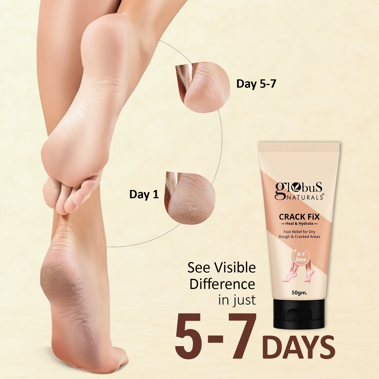 Globus Naturals Crack Fix Heel Repair Foot Cream For Dry, Rough And Cracked Heels 50gm