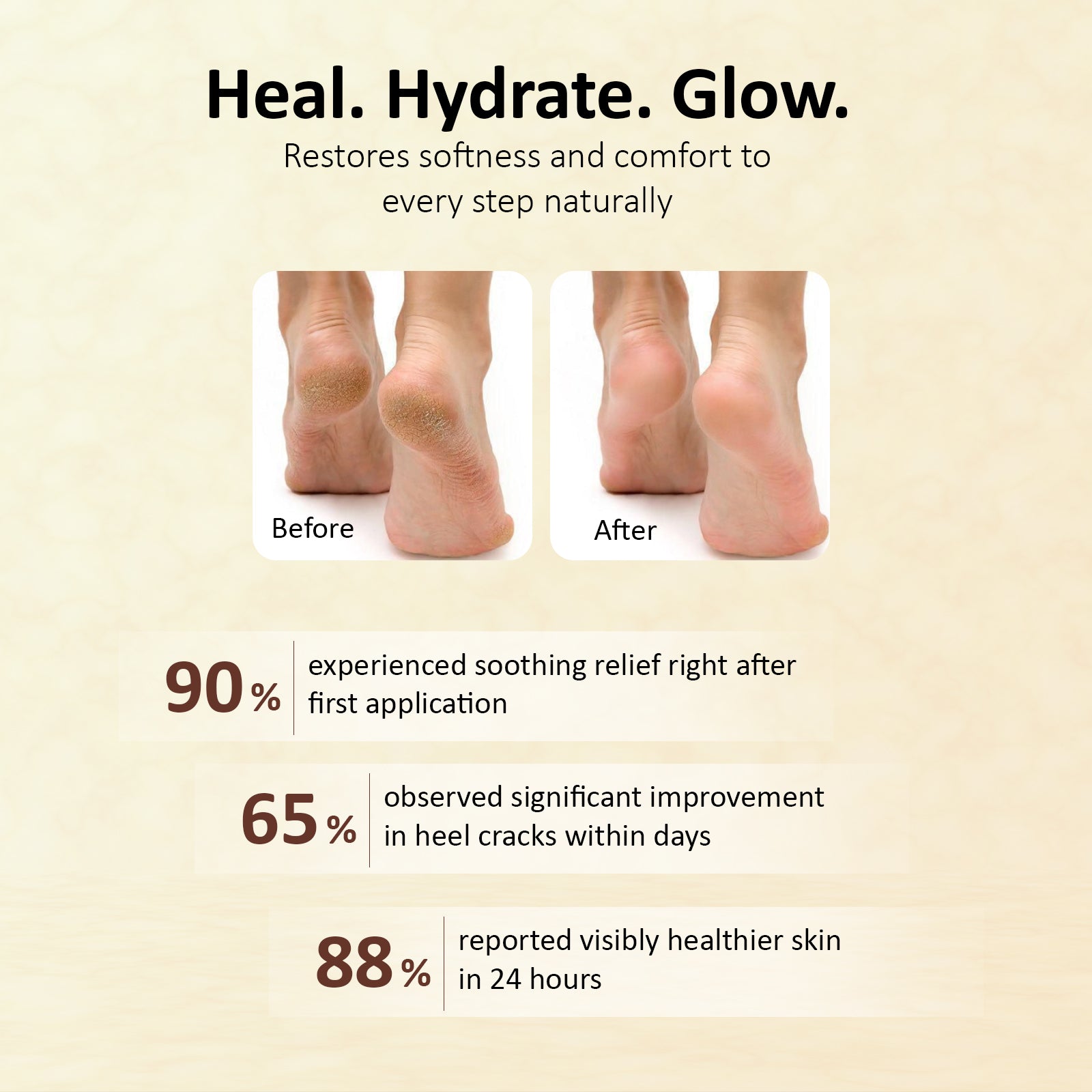 Globus Naturals Crack Fix Heel Repair Foot Cream For Dry, Rough And Cracked Heels 50gm