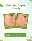 Aloe Vera Neem Tulsi Face Wash, 100 ml