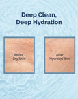 Globus Naturals Hyaluronic Acid Face Wash Refresh, Replenish Radiate Skin For All Skin Types 50gm