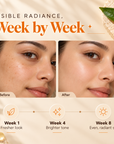 Globus Naturals Vitamin C Face Serum, for Natural Glow & Even Skin Tone, 30 ml